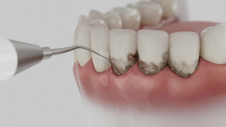Reliable Root Canal Treatment contractor in Jackson County County, KY by Dentist Open Now